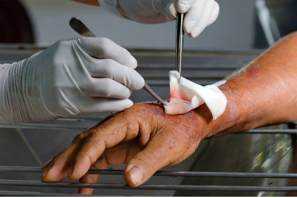 Wound Infection