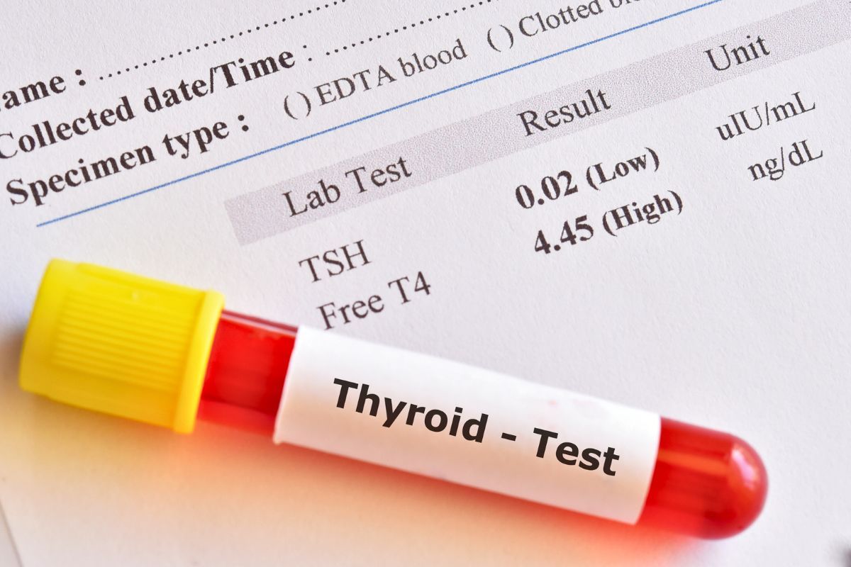 Interpretation of TSH, FT3, FT4 results in thyroid disorders