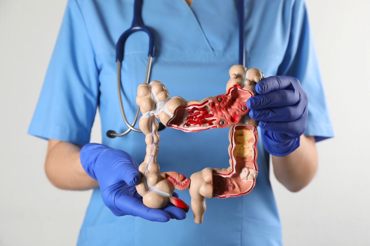 Rak jelita grubego objawy oraz skuteczna profilaktyka i diagnostyka