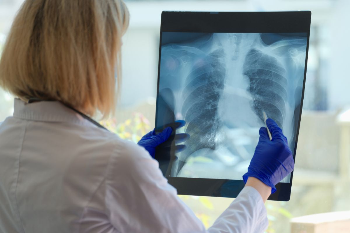Lung cancer symptoms at various stages and lung cancer diagnostics